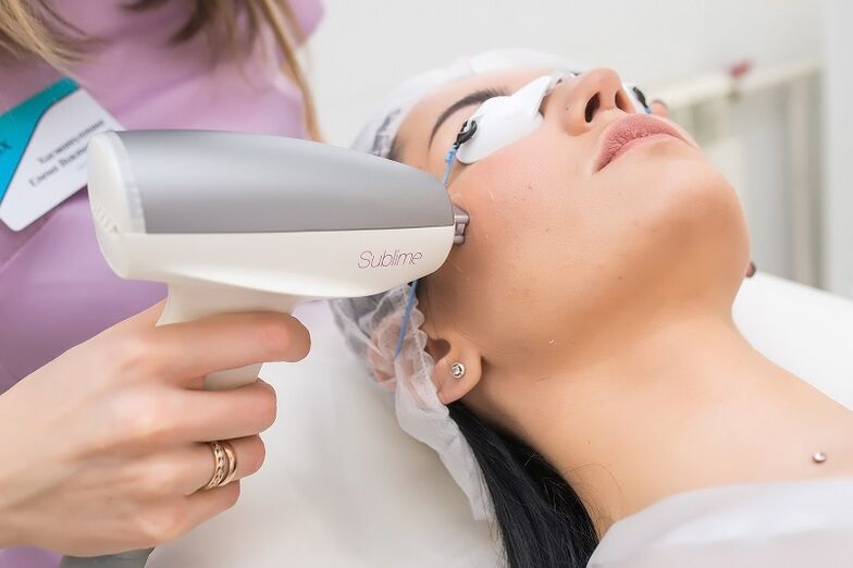 perform a laser skin resurfacing procedure