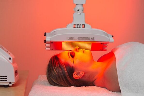 Hardware method of light therapy to prevent early signs of aging